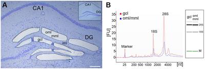 Layer-specific changes of KCC2 and NKCC1 in the mouse dentate gyrus after entorhinal denervation